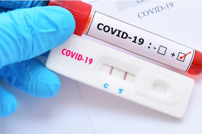 Teste de Covid-19 - ANS torna obrigatória cobertura por planos de saúde